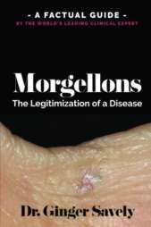 Morgellons: The Legitimization of a Disease - A Factual Guide by the World's Leading Clinical Expert by Dr. Ginger Savely